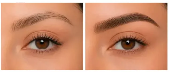 Before and after block: two photos compared side by side